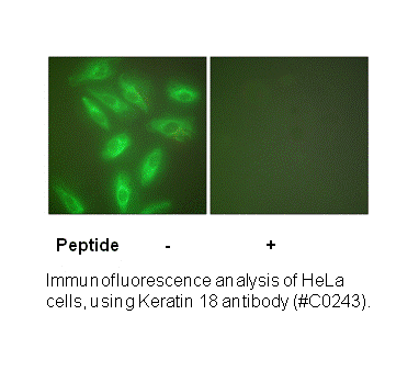 Product image for Keratin 18 Antibody