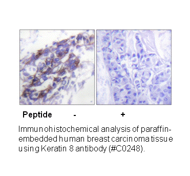 Product image for Keratin 8 Antibody