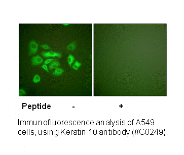 Product image for Keratin 10 Antibody