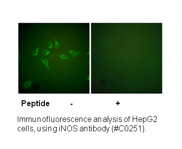 Product image for iNOS Antibody