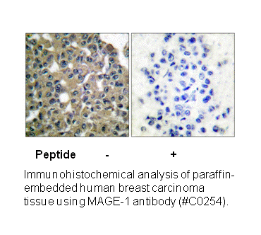 Product image for MAGE-1 Antibody