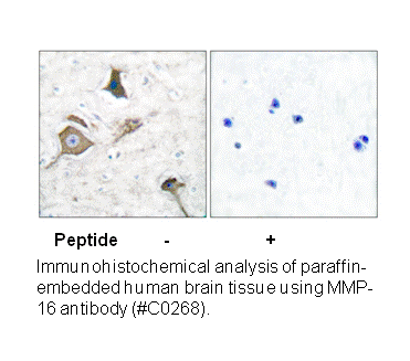 Product image for MMP-16 Antibody