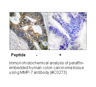 Product image for MMP-7 Antibody