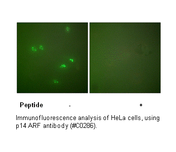 Product image for p14 ARF Antibody