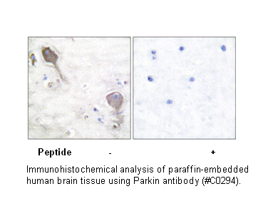 Product image for Parkin Antibody