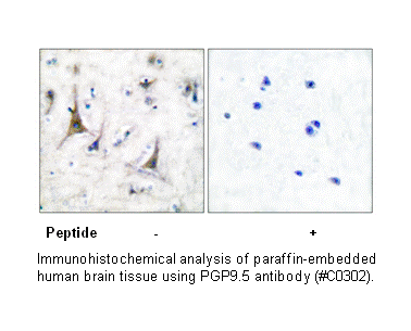 Product image for PGP9.5 Antibody