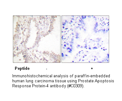 Product image for Prostate A8520 Response protein-4 Antibody