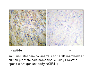 Product image for Prostate-specific Antigen Antibody