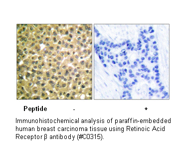 Product image for Retinoic Acid Receptor &beta; Antibody