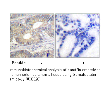 Product image for Somatostatin Antibody