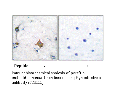 Product image for Synaptophysin Antibody