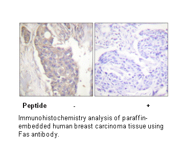 Product image for FAS Antibody