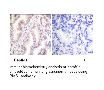 Product image for PIAS1 Antibody