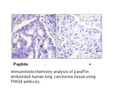 Product image for PIAS4 Antibody