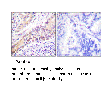 Product image for TOP2B Antibody