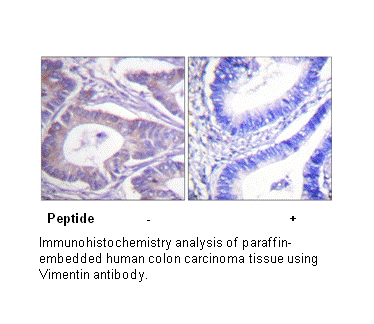 Product image for Vimentin Antibody