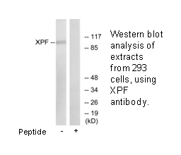 Product image for XPF Antibody