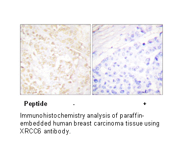 Product image for XRCC6 Antibody