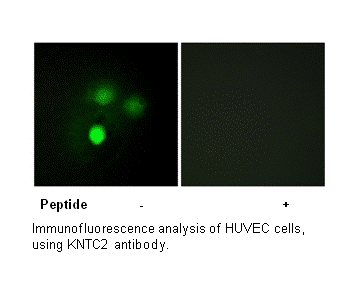 Product image for KNTC2 Antibody