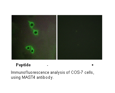 Product image for MAST4 Antibody