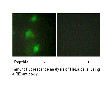 Product image for AIRE Antibody