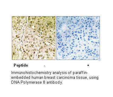 Product image for DNA Polymerase &theta; Antibody