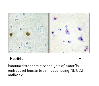 Product image for NDUC2 Antibody