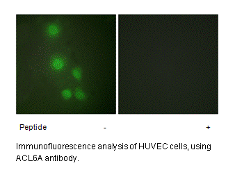 Product image for ACL6A Antibody