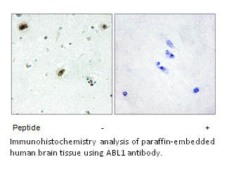 Product image for ABL1 Antibody