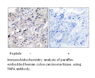 Product image for TNFA Antibody