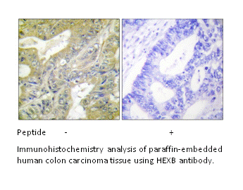 Product image for HEXB Antibody