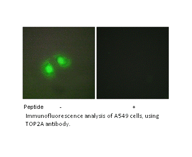 Product image for TOP2A Antibody