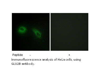 Product image for GLU2B Antibody