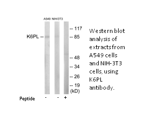 Product image for K6PL Antibody