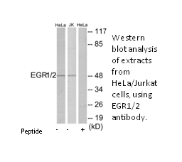 Product image for EGR1/2 Antibody