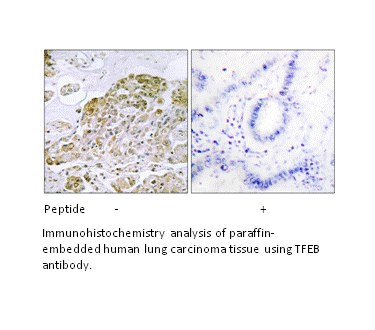 Product image for TFEB Antibody