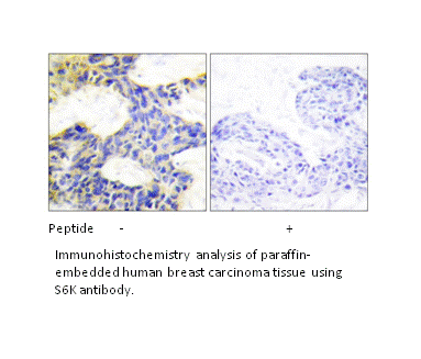 Product image for S6K Antibody