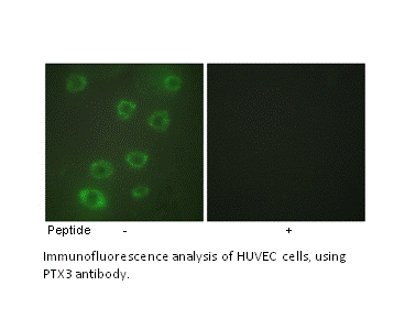 Product image for PTX3 Antibody