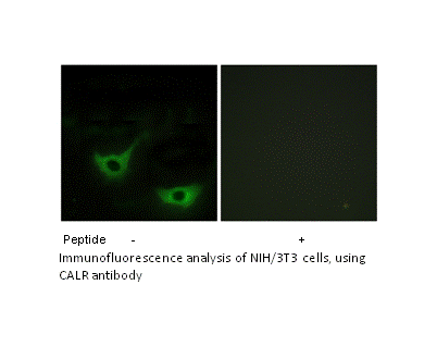 Product image for CALR Antibody