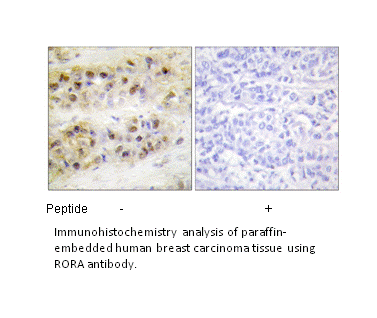 Product image for RORA Antibody