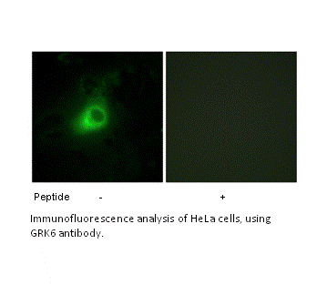 Product image for GRK6 Antibody