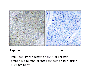 Product image for ETV4 Antibody