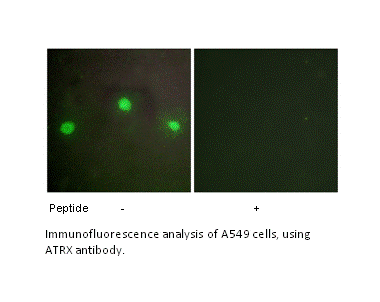 Product image for ATRX Antibody