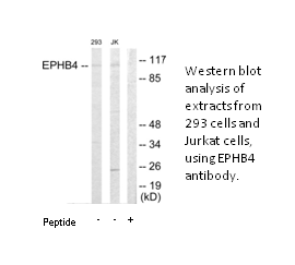 Product image for EPHB4 Antibody