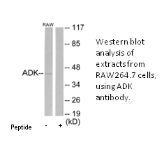 Product image for ADK Antibody