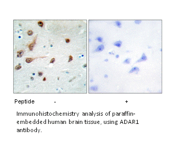 Product image for ADAR1 Antibody