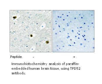 Product image for TPD52 Antibody