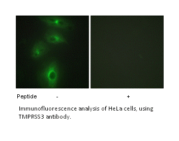 Product image for TMPRSS3 Antibody