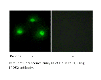 Product image for IPKA Antibody