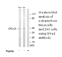 Product image for CKI-&gamma;2 Antibody